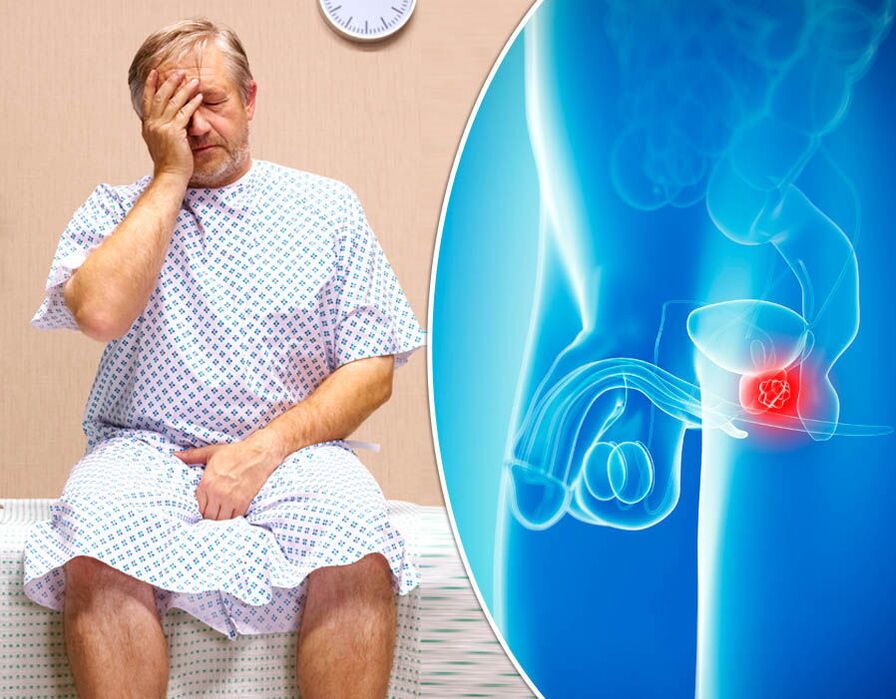 Muž s prostatitídou podstupuje diagnostiku ochorenia